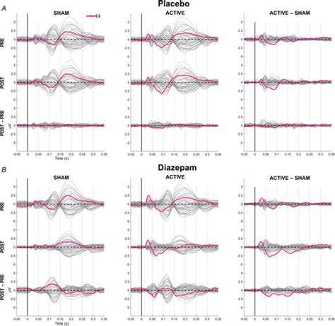 Untangling Tmseeg Responses Caused By Tms Versus Sensory Input Using