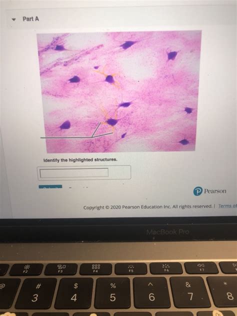 Solved Part A Identify The Highlighted Structures Pearson Chegg