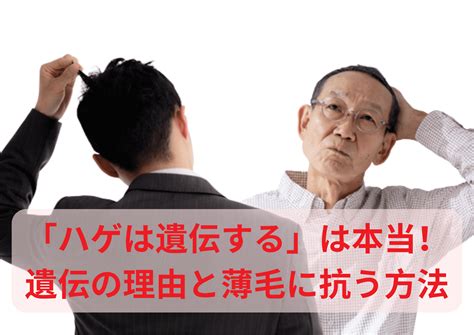 ハゲは遺伝するは本当遺伝する理由と薄毛に抗う方法を解説 AGAメディア