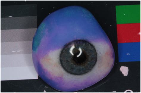 Investigate Prosthetic Eye New Zealand Prosthetic Eye Service