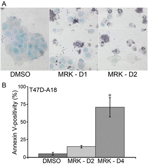 Inhibition Of Notch Signaling Reduces The Stem Like Population Of