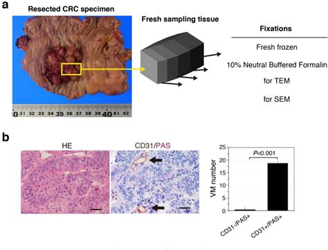 Figure From Human Colorectal Cancer Infrastructure Constructed By The