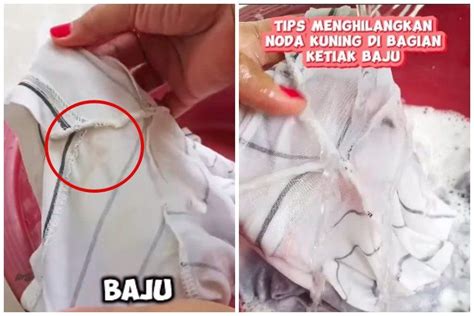 Tanpa Pemutih Ini Cara Ampuh Hilangkan Noda Kuning Di Ketiak Baju Cuma