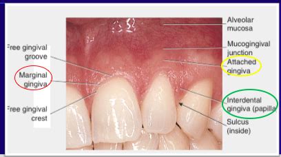 Ch Gingival And Dentogingival Junctional Tissue Dahe Flashcards