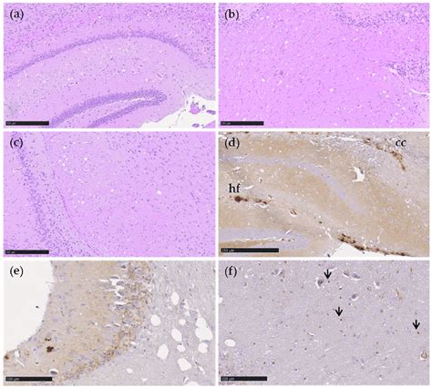 Vacuolation And Prp Sc In Transgenic Tgshpxi Mice Inoculated With