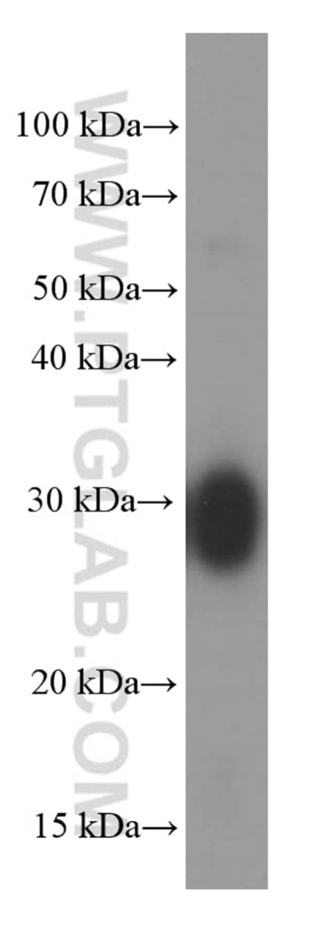 Clic4 Mouse Anti Human Porcine Rat Clone 1b7f9 Proteintech 20 μl