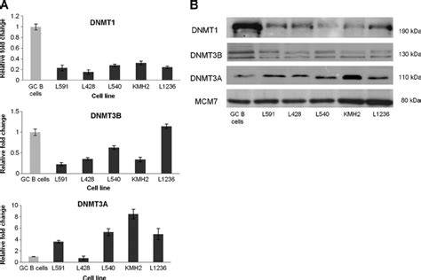 DNMT1 DNMT3B And DNMT3A Expression In Five HL Cell Lines A QRT PCR