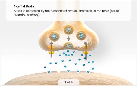 The DEPLIN® Difference: How Active Folate Enhances Antidepressant ...