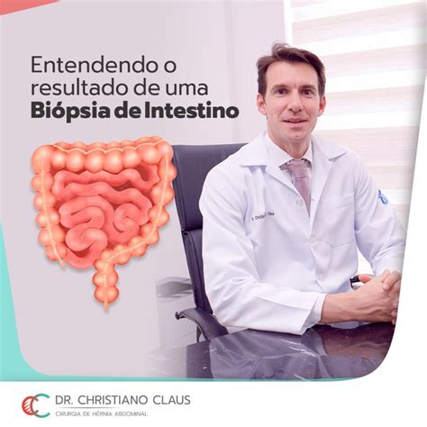 Entendendo O Resultado Da Bi Psia De Intestino Dr Christiano Claus