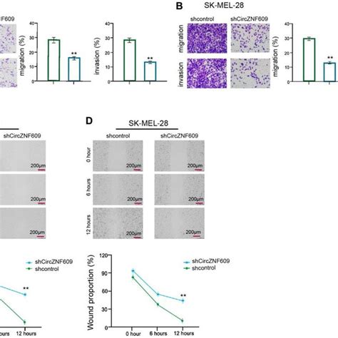 Circznf Enhances Invasion And Migration Of Melanoma Cells A D The