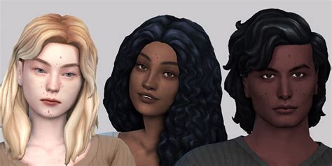 Best Sims 4 Acne Skin CC Details All Free FandomSpot