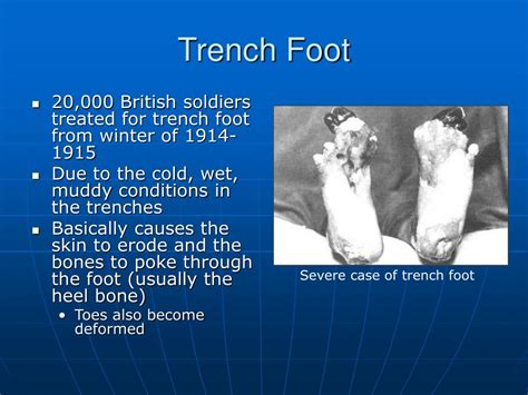 PPT The Great War Trench Warfare PowerPoint Presentation Free