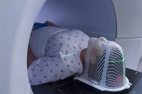 Brain Tumor Radiation Therapy