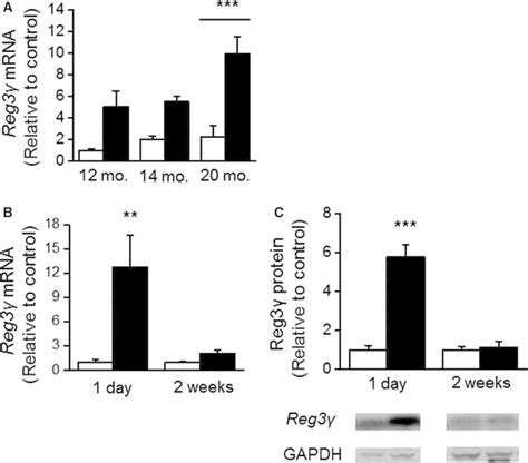 Cardiac Regenerating Islet Derived Reg Gene Expression In