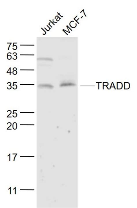 TRADD Rabbit anti Human Polyclonal Bioss 100 μL Unconjugated