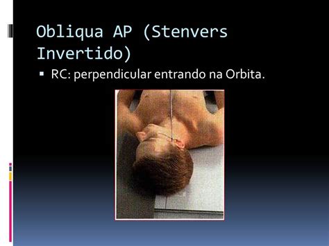 radiologia dinamica metodo de stenvers invertido chausse iv mayer