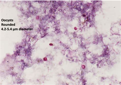 Lecture 3 Intestinal Tissue Coccidia Flashcards Quizlet