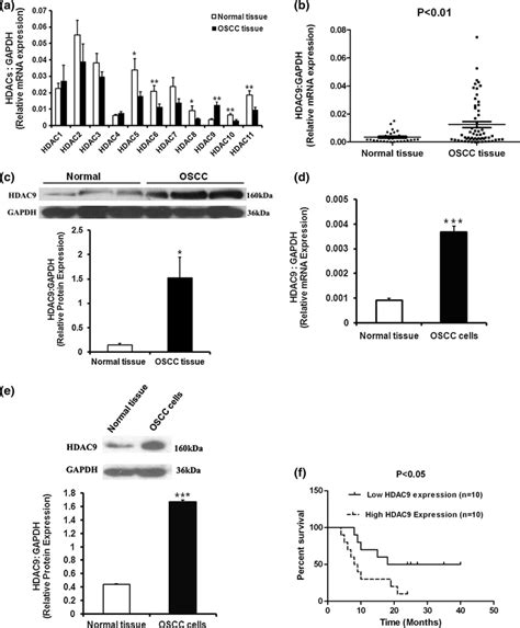 Hdac9 Is Overexpressed In Oscc Clinical Specimens And Oscc Cells A