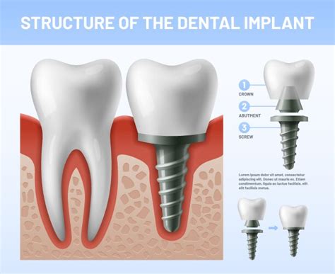 Teeth Maquette Structural Elements Of Dental Vector Image