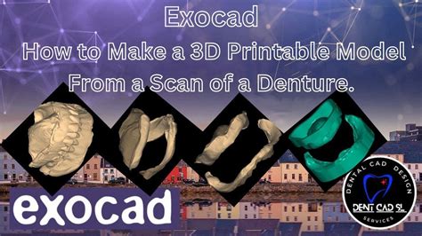 Exocad How To Make A D Printable Model From A Scan Of A Denture