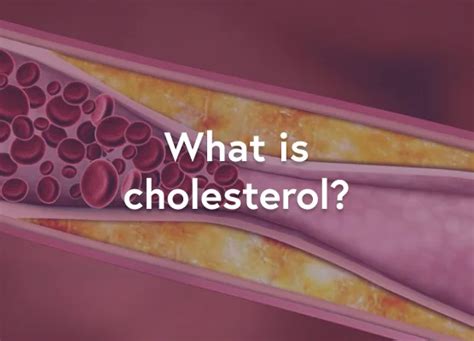 What Is Cholesterol Faqs