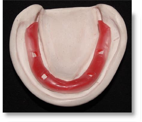 Step by step Guide for Understanding the Prosthodontics: Complete ...