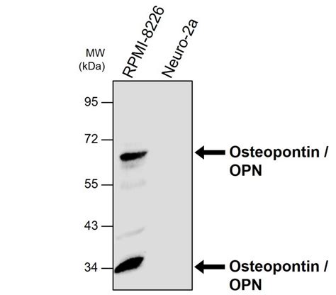 Osteopontin OPN Antibody C1H3 IRM216 IReal Biotechnology Inc