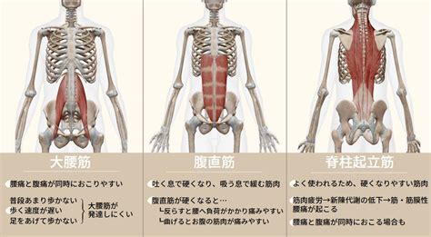 腰痛と腹痛が同時におこる！医師から大丈夫と言われたけれど何が原因？ 腰痛メディア｜zen Placeが発信する痛みの情報サイト