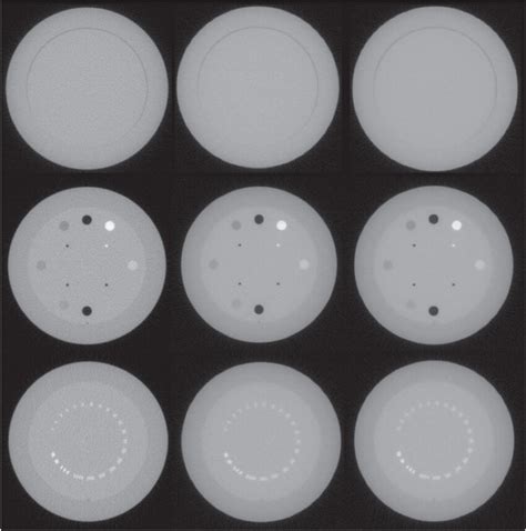 Axial Image Slices Of Phantom Modules Ctp486 Top Row Ctp404 Middle Download Scientific