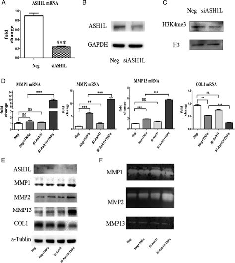 Ash L Knockdown Up Regulated Mmp Expression And Activity In Hdpcs