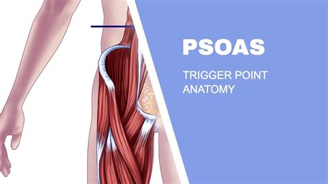 Psoas Muscle Trigger Point