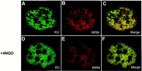 Nuclear Localization Of Ku And Wrn By Immunofluorescence Actively