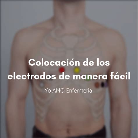 Colocación De Electrodos Ecg Ekg