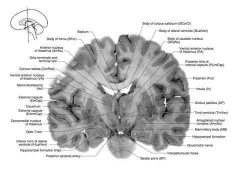 Lab Coronal Sections Part Iv Diagram Quizlet