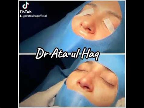 Piezoultrasonic Rhinoplasty By Dr Ata Ul Haq In Lhr Book Ur Appoitment