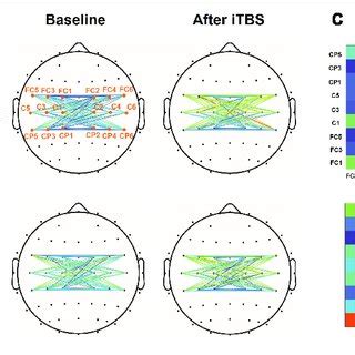 Beta Band Interhemispheric Functional Connectivity Change After Itbs