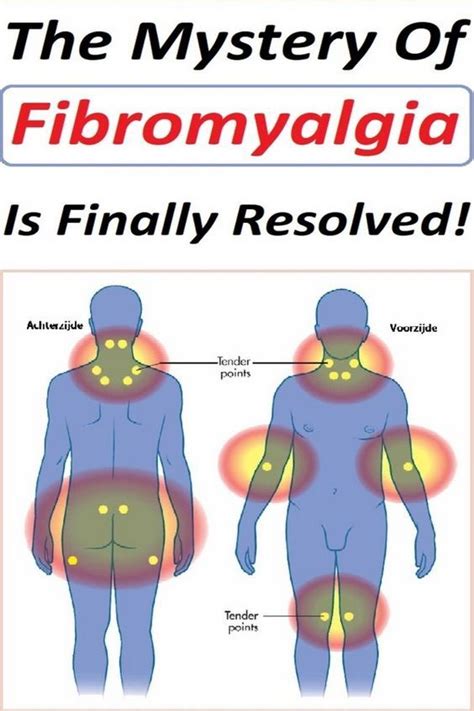 The Mystery Of Fibromyalgia Is Finally Resolved! | Fibromyalgia ...