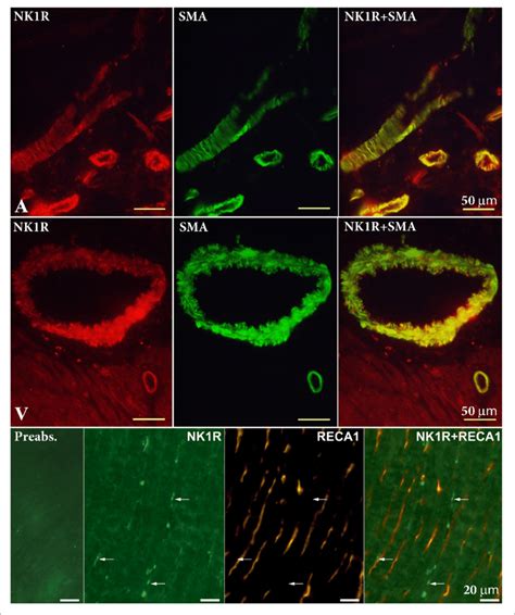 Double Labeling Immunohistochemistry For Nk1 Receptor Nk1r And