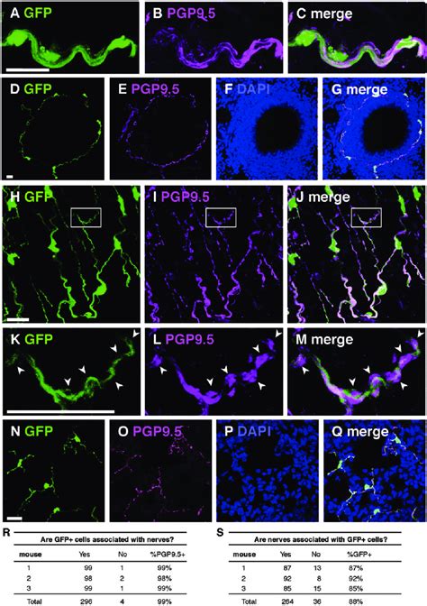 GFP And PGP9 5 Immunostaining In Lungs Of GFAPcre GFP Transgenic Mice