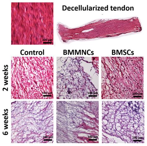 Ijms Free Full Text Effect Of Freshly Isolated Bone Marrow