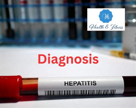 Hepatitis Causes Symptoms Treatment And Prevention Fitness