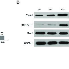 The Effects Of OGD R Exposure On The Activation Of Rac1 And The