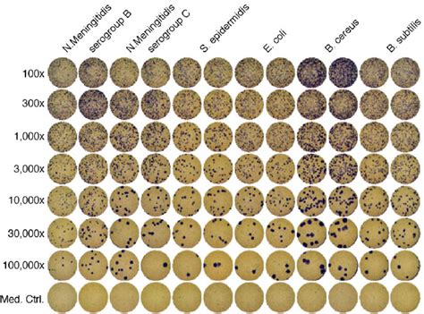 Whole Plate Image Of Bacterial Cultures Plated At Dilutions From 1100 Download Scientific