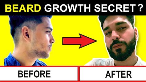 How To Grow Beard Faster Naturally Grow Patchy Beard Tips To Grow