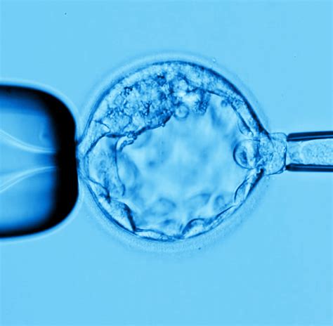 The Blastocyst Biopsy - RGI