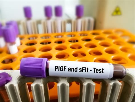 The Reproducibility Of The 75 Gram Glucose Tolerance Test Pregnancy Surviving Diabetes