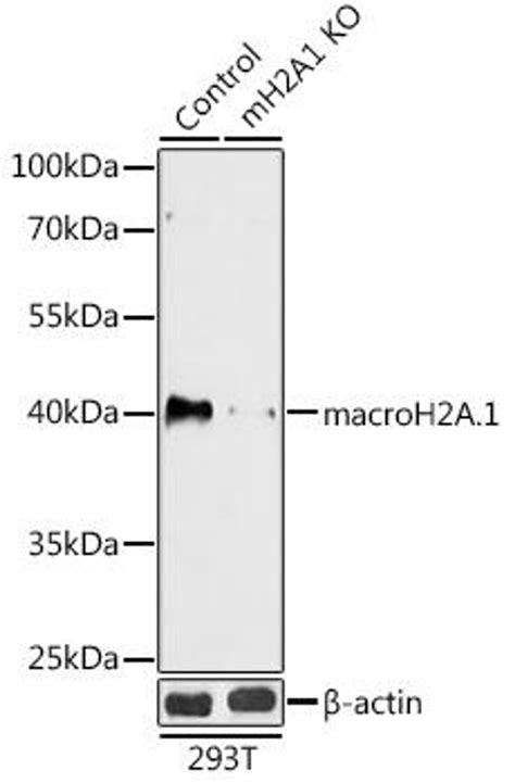 Anti Macroh2a1 항체 Cab18091 Assay Genie