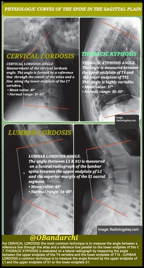 Dr Omid Bandarchi M D On Twitter Threadunrollbot Please Grap This