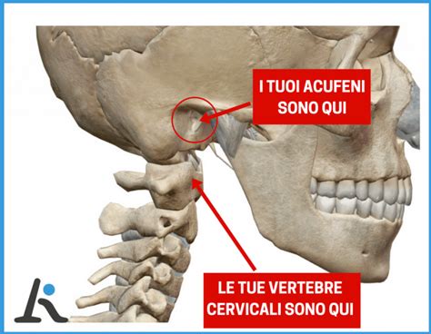 Sindrome Cervicale Di Barre E Acufeni