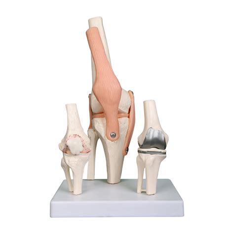 Buy Kay Kay Industries Premium Knee Joint Model Anatomy Set Life Size